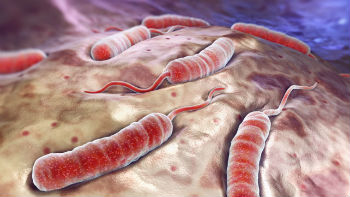 Cholera is a killer disease, easily treated, but without care, will kill half of its victims.