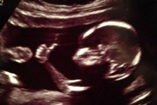 Planned Parenthood was exposed two years ago for selling aborted baby body parts.