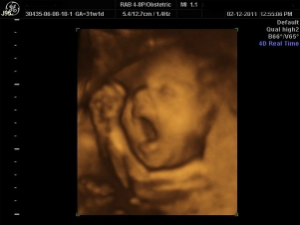 Does this look like a baby or a cluster of cells?