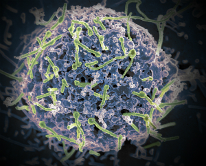 Disease X is out there, and it is just a matter of time.