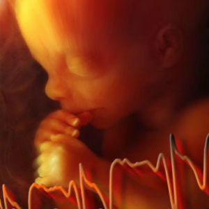 Doctors are prohibited from performing an abortion after the detection of the baby's heartbeat.