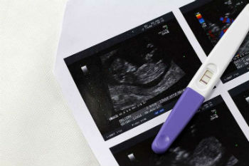 Abortion Indiana Law