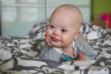 Image of Baby with Down Syndrome