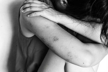 Abuse victim
