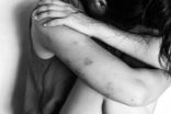 Image of Abuse victim