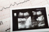 Image of Cardiogram ultrasound baby pregnant