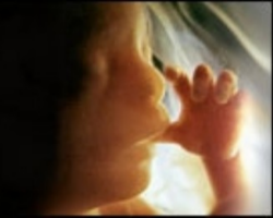 Image of For 35 years we have prayed, marched, litigated, and tried to persuade our fellow Americans and people throughout the Western world that every procured abortion is the intentional killing of innocent human life. Our challenge persists. In addition to continuing all of these efforts, perhaps it is time to take a new tact in the verbal debate. It is time to call those who support legalized abortion the 