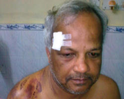 Image of Pictured: Bishop and Priests at the funeral of the martyr Fr. Thomas Pandippally. The Fr. Thomas Chellan who gave this interview survived the assault against him. He is still eager to serve the Lord and inspired by the witness of Indian Christians who persevere for the ancient Catholic faith.