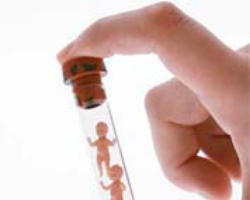 Image of The body of a human being, from the very first stages of its existence, can never be reduced merely to a group of cells. The embryonic human body develops progressively according to a well defined program with its proper finality, as is apparent in the birth of every baby.(CDF) 