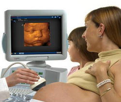 Image of According to an article in the Washington Examiner, between seventy and ninety-percent of 'abortion minded' mothers who see an ultrasound choose life, making this pre-natal portrait one of the most important allies of the unborn.