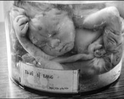 Image of Many who use the 'Social Justice' arguments in this debate also support the intrinsically evil and utterly indefensible inclusion of abortion as a 'health care service' in all of the current proposals for health care reform.That is patently unjust!