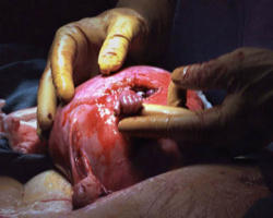 Image of Pray that this bill will be used to open the eyes of many in our country who will not yet acknowledge the truth written on every human heart -- the child in the womb is one of us.