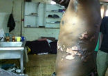 Image of Torture of Eritreans in the Sinai.