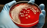 Image of Bacteria are becoming resistant to common antibiotics in both the lab and our bodies. 