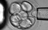 Image of Swedish scientists say they can now extract a single stem cell from an embryo without killing the embryo 