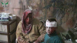Image of Civilians injured in an alleged bombing in Homs. Many more are starving and the UN cannot provide aid due to the ongoing siege. Some civilians have been evacuated and fed, many more have escaped on their own, but most remain besieged. 
