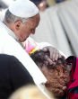 Image of Pope Francis prays will a disfigured man. What matters more however, is what our soul looks like on the inside. Are we disfigured inside?