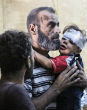 Image of Injured Syrians during alleged NAPALM attack from Assad.