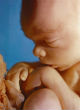 Image of Researchers and pro-life advocates demand the retraction of an article claiming 20-week-old babies do not feel pain (prolifecouncilct.org).