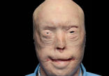 Image of Patrick Harden before his face transplant. 