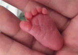 Image of Baby Emilia was born weighing only 8-ounces (CEN).