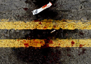 Image of He was left unconscious on the road (not pictured).