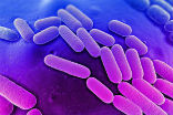 Image of Klebsiella pneumoniae is a common bacteria found virtually everywhere. But at least one strain is resistant to all antibiotics. 