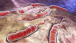 Image of Cholera is a killer disease, easily treated, but without care, will kill half of its victims. 