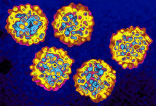 Image of Hepatitis is a killer, and takes more lives than HIV, tuberculosis, and malaria combined. It can be treated cured, but the political will to eradicate the disease is low. 