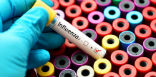 Image of This is a bad year for the flu and doctors are asking the sick to stay home. 