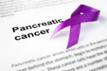 Image of Pancreatic cancer is one of the most lethal forms of the disease. 