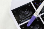 Image of Pregnancy test